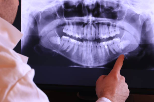 Best Emergency Dentist for Special Needs Patients in Flora, IL