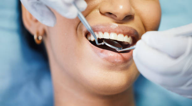 Best Emergency Dentist for Lost Fillings or Crowns in Flora, IL