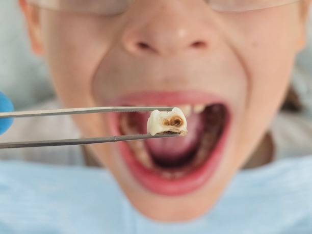Best Pediatric Emergency Dentist in Flora, IL